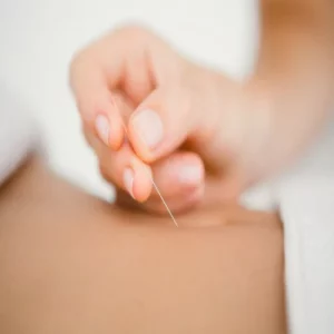 Acupuntura Distal Jacobo Navarro